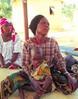 Une mère et son enfant qui est atteint du Noma